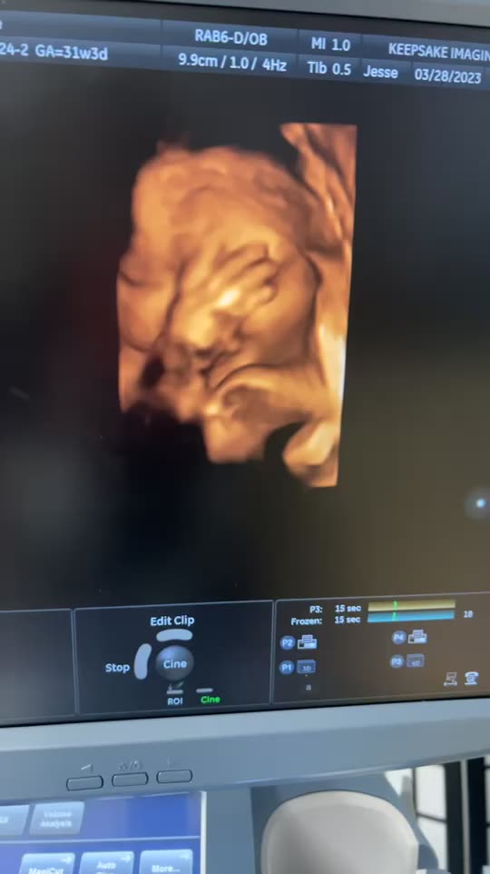 Keepsake Imaging Studio (ultrasoundwyo) Snapchat Stories, Spotlight