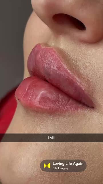 c type lips Loving Life Again